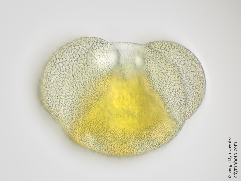 Conifer pollen under the microscope Sdym photo